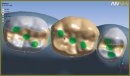 Биомеханика металлокерамических мостовидных протезов при замещении малых дефектов боковых отделов зубных рядов