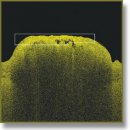 Обнаружение атеросклеротических бляшек по изображениям оптической когерентной томографии с использованием метода структурной сегментации