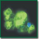 Тест-система «Биочип-SER» для флюоресцентного иммуноцитохимического исследования экспрессии антигена Ep-CAM на материале выпотных жидкостей и смывов