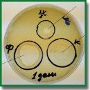 Исследование <i>in vitro</i> жизнеспособности бактериофагов в составе комплексных гидрогелевых раневых покрытий