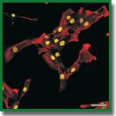 Пролиферативная активность здоровых и дегенерированных клеток межпозвонкового диска <i>in vitro</i> при воздействии костных морфогенетических протеинов: возможности для клеточной терапии