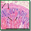 Trans-Serosal Multimodal Optical Coherence Tomography for Visualization of Microstructure and Blood Circulation of the Small Intestine Wall