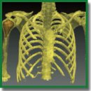 Применение 3D-моделирования и компьютерной навигации в хирургическом лечении пациентов с доброкачественными опухолями и опухолеподобными заболеваниями трубчатых костей скелета