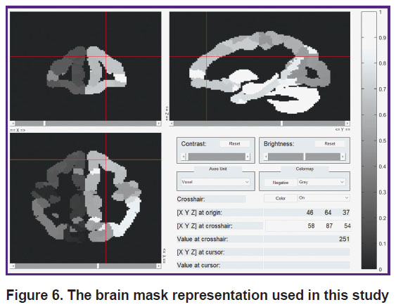 Mental chronometry - Wikipedia