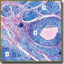Spatial Organization Types of Sinoatrial Node in Dogs with Different Body Functional Reserve Levels