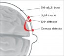 Cerebral Infrared Oximetry in Intracranial Hemorrhage
