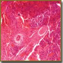 Features of Morphological Changes in Experimental CT-26 Tumors Growth