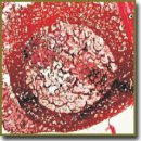 Tibial Remodelling During Bone Defect Management Using Multilevel Fragment Lengthening (Experimental Findings)