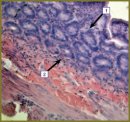 Experimental Justification of Enteral Lavage by Osmotically Active Solution in Acute Intestinal Obstruction Complicated by Intraabdominal Hypertension