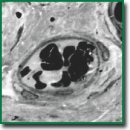 A Novel Technique for Preparation, Staining, and Visualization of Tissue with Metal Implants and Extraskeletal Calcification Areas