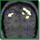 Two Visual Systems and Their Eye Movements: a Fixation-Based Event-Related Experiment with Ultrafast fMRI Reconciles Competing Views