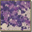 Biocompatible Synthetic Tracheal Matrices Based on Polymer Ultra-Fibrous Materials Colonized by Mesenchymal Multipotent Cells