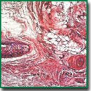 Subcutaneous Implantation of Poly(3-hydroxybutyrate-co-3-hydroxyvalerate) and Poly(ε-caprolactone) Scaffolds Modified with Growth Factors