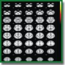 The Activity of Human Mirror Neurons during Observation and Time Perception