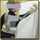 The Development and Clinical Testing of “EXAR”, Passive Upper Limb Exoskeleton
