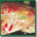 Quantitative Cross-Polarization Optical Coherence Tomography Detection of Infiltrative Tumor Margin in a Rat Glioma Model: a Pilot Study