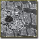 Biologic Effect of Low-Intensity Electromagnetic Radiation on Myocardium in Experimental Ischemia