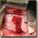 Application of Polymer Phospholipid Matrix for Closing Open Wounds on Oral Mucosa