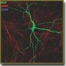 The Influence of Different Types of Upconversion Nanoparticles Surface Coatings on Neurotoxicity