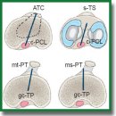 Rotational Alignment of Components in Total Knee Arthroplasty (Review)