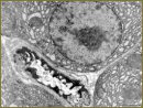 The Use of Complex Assessment of Morphofunctional State of Pancreatic Microvasculature to Study the Adaptation of the Body to Motor Activity in Impaired Glucose Tolerance