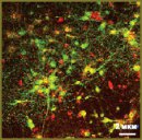 Multielectrode Matrices — New Possibilities  in Investigation of the Neuronal Network Plasticity