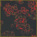 Integrated Study of the Interaction Between Gold Nanorods  and Cancer Cells