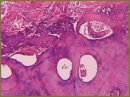 The Study of Barrier Function of Collagen Membrane “Osteoplast” in Healing Bone Defects in an Experiment