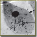 Method for Evaluating the Effectiveness of Combined Treatment with Immunomodulators in Chronic Dermatologic Diseases