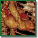 A New Look at Structural Changes in the Aortic Root in Aortic Valve Stenosis