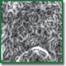 Radiomics in Breast Cancer: In-Depth Machine Analysis of MR Images of Metastatic Spine Lesion