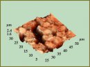 Morphofunctional Status of Erythrocytes in Cervical Cancer Patients after Femtosecond Laser Radiation Exposure