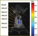 The Study of the Interaction of Mesenchymal Stem Cells and the Tumor Using the Methods of Fluorescent Bioimaging