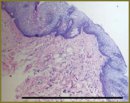 Numerical Analysis of Cross-polar Optic Coherent Tomography Images in Functional Diagnostics of Intestinal Diseases by the Condition of Oral Soft Tissues