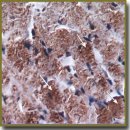 Atrial and Brain Natriuretic Peptides of Secretory Cardiomyocytes in Salt Loading in Experiment