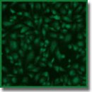 Cytotoxicity of Xenogeneic Pericardium Preserved by Epoxy Cross-Linking Agents