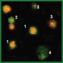 Production of Platelet-Rich Gel Using Allogeneic Platelets Isolated from Donor Whole Blood