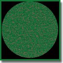 Clinical and Pathogenetic Significance of Amylase Level and Microtomographic Index of Synovial Fluid in Various Joint Lesions