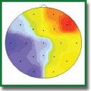 Correlations between the EEG Spectral Characteristics and the Severity of Autistic Manifestations