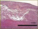 Cross-Polarization Optical Coherence Tomography in Evaluation of Atherosclerotic Plaque Structure