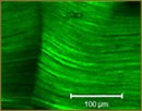 Collagen Structural Changes in Early Radiation-Induced Damage
