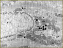 The Relationship of Synthesis Intensity, Accumulation and Secretion of Natriuretic Peptide of Atrial Myocytes with Cardiac Rhythm Regulation in Rats in Early Postperfusion Period