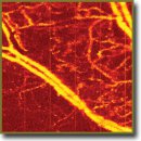 The Development of the Methodology of Monitoring Experimental Tumors Using Multimodal Optical Coherence Tomography: the Choice of an Optimal Tumor Model	