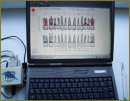 The Experience of Using Computer System Florida Probe for Periodontal Inflammatory Diseases Diagnosis