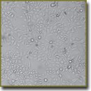 Effect of Ozone and Doxorubicin on the Viability and Morphology of Malignant Hepatic Cells