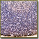 Rat Thymocyte Apoptosis and Proliferation Variations in Chronic Exposure to Low-Dose Dichlorodiphenyltrichloroethane
