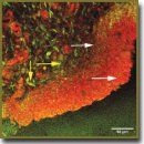 ​Multiphoton Microscopy in the Study of Morphological Characteristics of Radiation-Induced Injuries of the Bladder