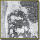 The Effect of Mexidol on Brain Natriuretic Peptide  of Cardiomyocytes in a Post-Reperfusion Period in Experiment
