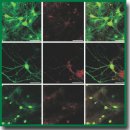 Effect of Photosensitizers Photosens, Photodithazine and Hypericin on Glioma Сells and Primary Neuronal Cultures: a Comparative Analysis