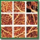 Effect of Surgical Technique on the Microstructure and Microcirculation of the Small Intestine Stump during Delayed Anastomosis: Multimodal OCT Data